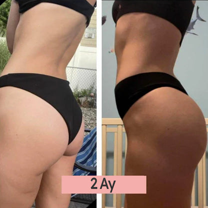 VeraFit™ Kalça Şekillendirici EMS Cihazı