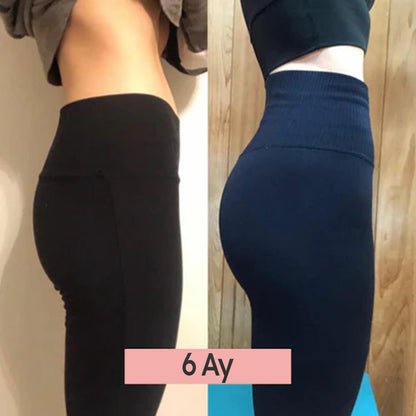 VeraFit™ Kalça Şekillendirici EMS Cihazı